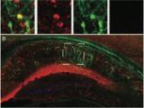 Neuronal activity snapshot